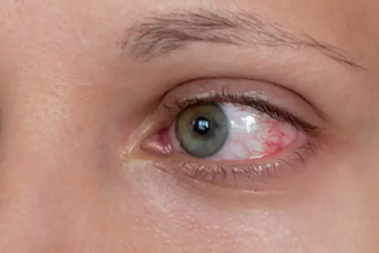 高クレアチニンに伴う症状